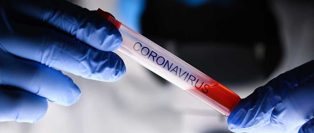 Impact coronavirus op bedrijfsvoering