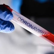 Impact coronavirus op bedrijfsvoering